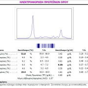 Μακροσφαιριναιμια Waldenstrom