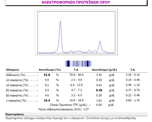 Μακροσφαιριναιμια Waldenstrom