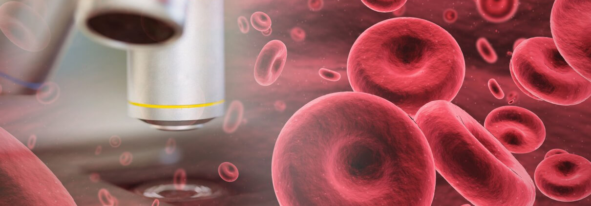 αίμα μικροσκόπιο slide