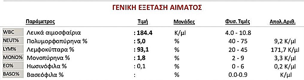 λεμφοκυττάρωση, λεμφοκύτταρα ανεβασμένα Ανεβασμένα λεμφοκύτταρα σε χρόνια λεμφοκυτταρική λευχαιμία