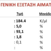 Ανεβασμένα λεμφοκύτταρα σε χρόνια λεμφοκυτταρική λευχαιμία